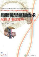 腹腔镜胃癌根治术淋巴结清扫技巧
