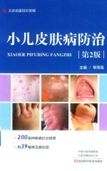 小儿皮肤病防治 第2版