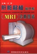 肝脏移植磁共振 MRI 诊断图谱