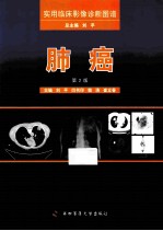 肺癌 第2版