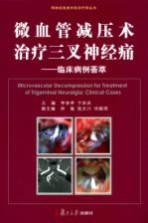 微血管减压术治疗三叉神经痛 临床病例荟萃