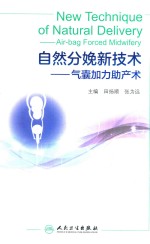 自然分娩新技术 气囊加力助产术