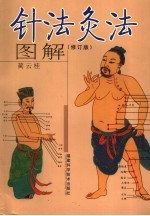 针法灸法图解 修订版