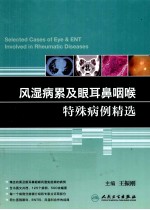 风湿病累及眼耳鼻咽喉特殊病例精选