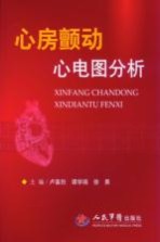 心房颤动心电图分析