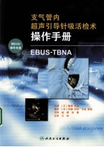 支气管内超声引导针吸活检术(EBUS-TBNA)操作手册