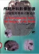 颅脑外科影像图谱 放射外科和立体定位