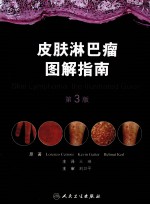 皮肤淋巴瘤图解指南 第3版