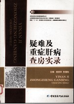 疑难及重症肝病查房实录
