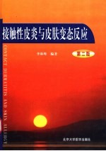 接触性皮炎与皮肤变态反应