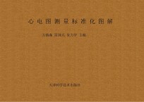 心电图测量标准化图解