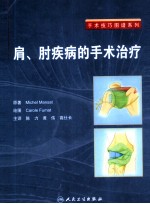 肩、肘疾病的手术治疗