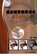 腹腔镜胃癌根治术淋巴结清扫技巧