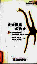 皮炎湿疹的治疗