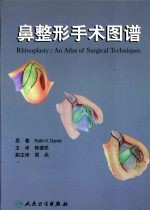 鼻整形手术图谱 an atlas of surgical techniques