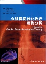 心脏再同步化治疗病例分析