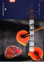 心电图临床实习图谱 第2版