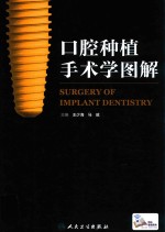 口腔种植手术学图解