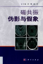 磁共振伪影与假象