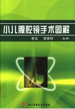 小儿腹腔镜手术图解
