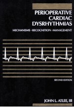 PERIOPERATIVE CARDIAC DYSRHYTHMIAS MECHANISMS