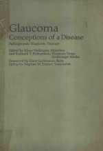 GLAUCOMA CONCEPTIONS OF A DISEASE PATHOGENESIS