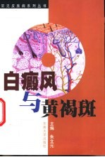 白癜风与黄褐斑