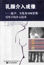 乳腺介入成像 超声、X线及MR影像引导下的介入技术
