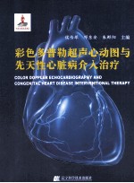 彩色多普勒超声心动图与先天性心脏病介入治疗