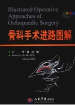骨科手术进路图解 彩图版
