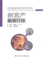 剖宫产瘢痕妊娠