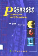 经皮椎体成形术