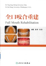 全口咬合重建
