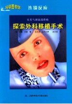 科学图书馆 从笑气到面部移植 探索外科移植手术