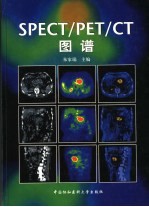 SPECT/PET/CT图谱