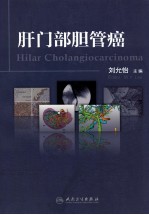 肝门部胆管癌