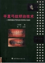 平直弓丝矫治技术