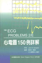 心电图150例详解