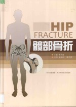 髋部骨折