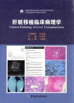 肝脏移植临床病理学