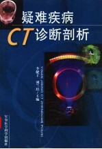 疑难疾病CT诊断剖析