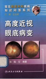高度近视眼底病变