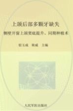 上颌后部多颗牙缺失 侧壁开窗上颌窦底提升、同期种植术