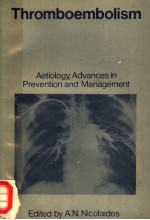 THROMBOEMBOLISM AETIOLOGY