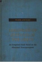 DIAGNOSIS OF DISEASES OF THE CHEST AN INTEGRATED STUDY BASED ON THE ABNORMAL ROENTGENOGRAM BOLUME