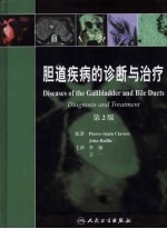 胆道疾病的诊断与治疗 翻译版