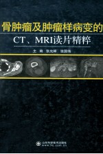 骨肿瘤及肿瘤样病变的CT、MRI读片精粹