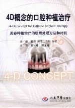 4D概念的口腔种植治疗 美容种植治疗的组织处理方法和时机
