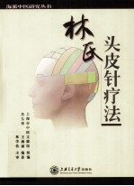 林氏头皮针疗法