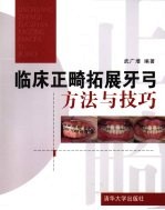 临床正畸拓展牙弓方法与技巧
